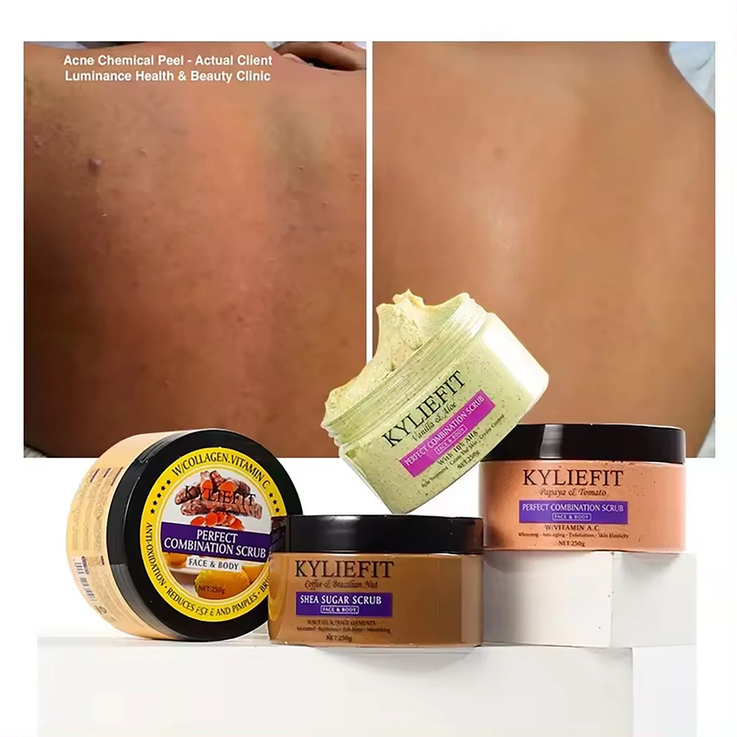 KYLIEFIT Natural Exfoliating Salt Body and Face Scrub, Helps with Moisturizing Skin, Dark Spots, Cellulite, Dead Skin, Wrinkles