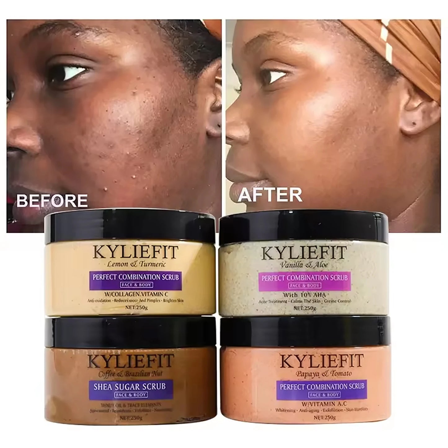 KYLIEFIT Natural Exfoliating Salt Body and Face Scrub, Helps with Moisturizing Skin, Dark Spots, Cellulite, Dead Skin, Wrinkles