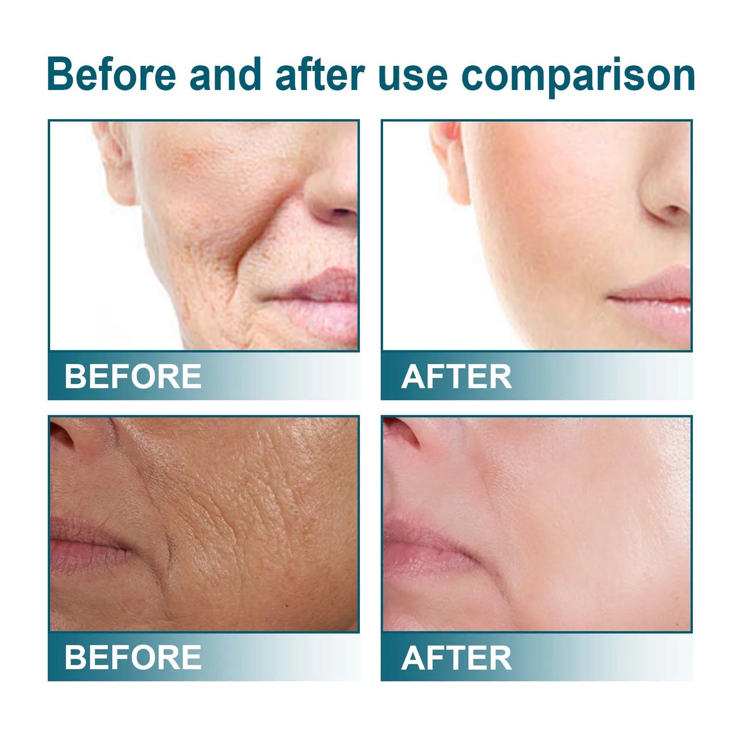 HOYGI Vitamin C facial essence lifts, tightens, reduces fine lines, moisturizes, softens, brightens, nourishes and protects skin