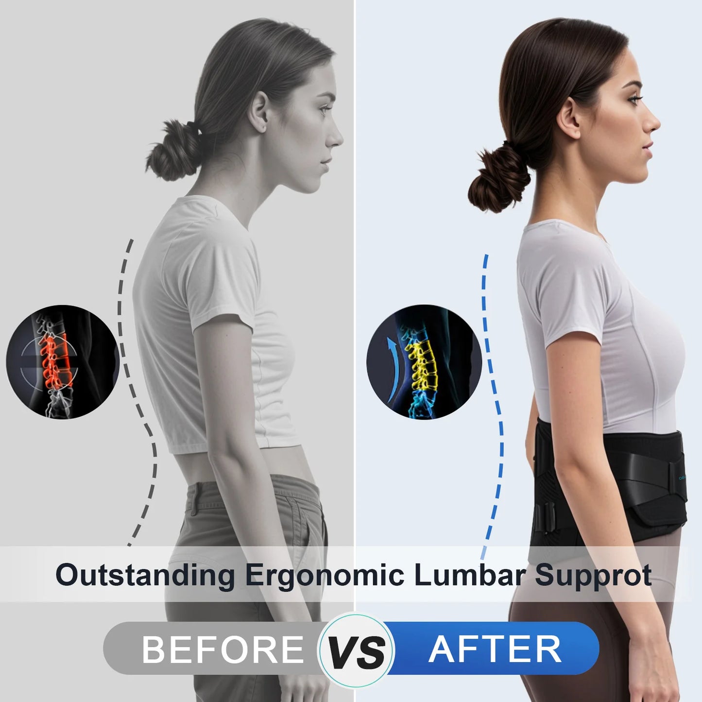 Cofoe Back Brace Waist Brace with Fixed plate, Adjustable Waist Belt For Lower Back Pain, Sciatica, Herniated Disc, Scoliosis